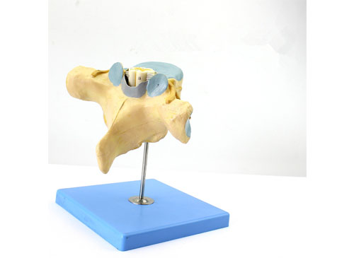 胸椎附脊髓和脊神经放大模型