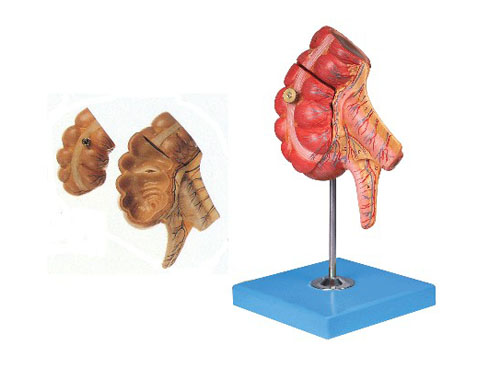 盲肠和阑尾模型
