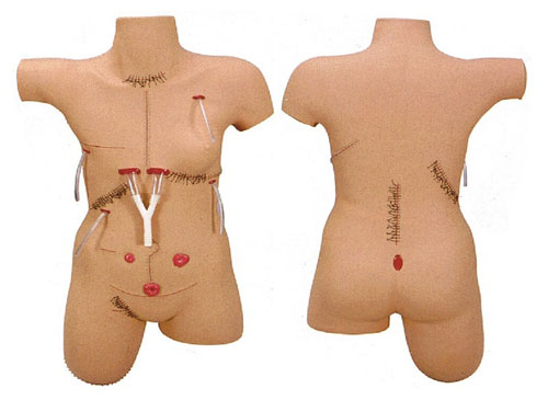 高级外科手术伤口护理模型