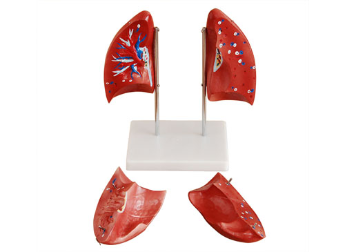 肺解剖模型