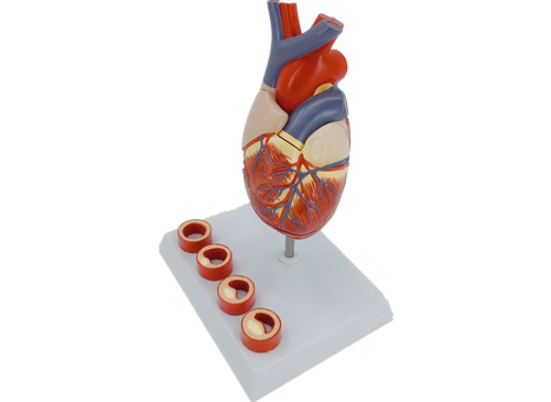 心脏带血栓模型