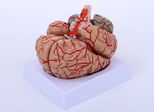脑及脑动脉模型