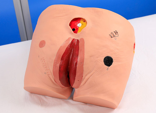 压力性损伤模型